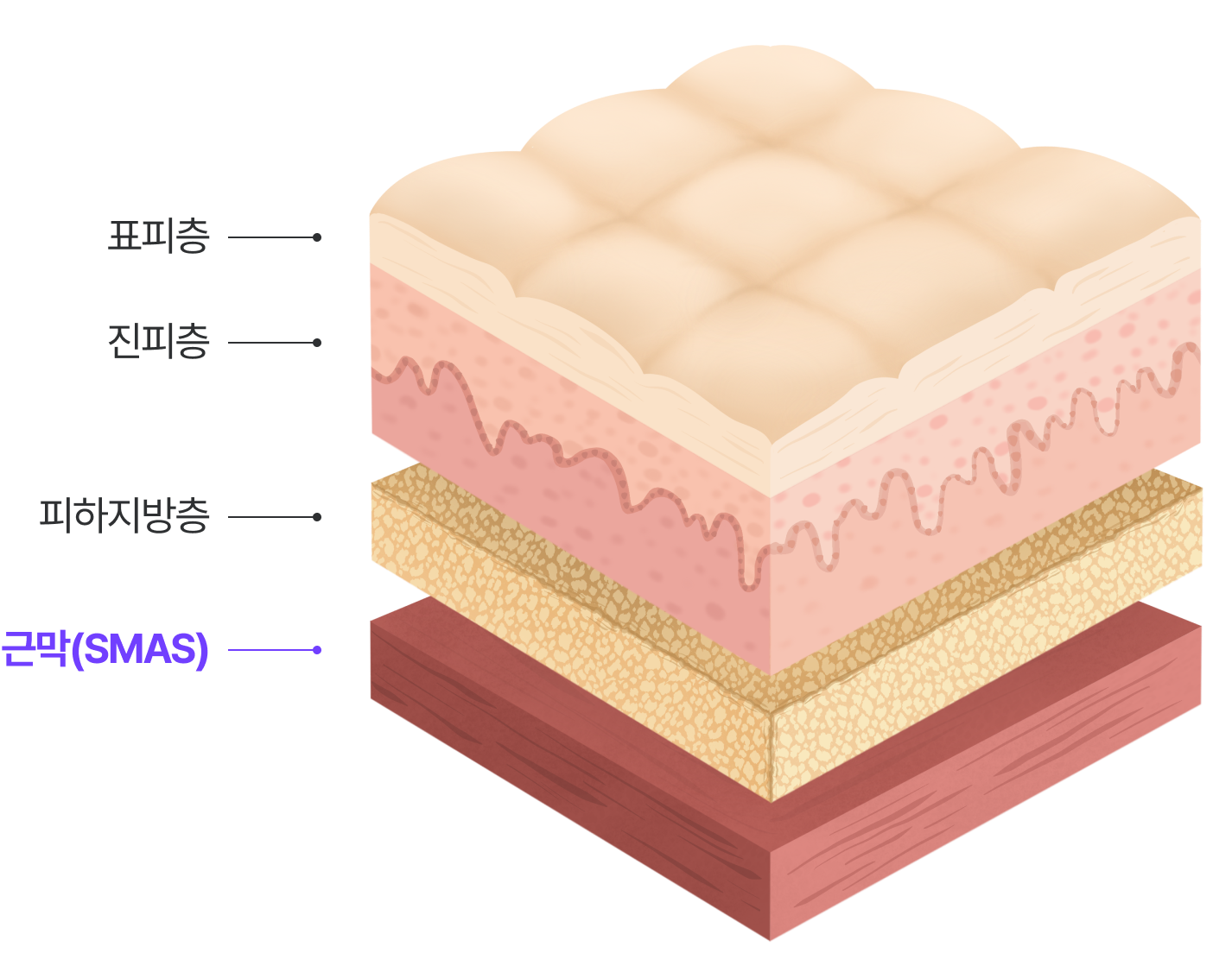 스마스층 : 근막(SMAS), 피하지방층, 진피층, 표피층
